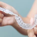 Nakładki Invisalign Szczecin